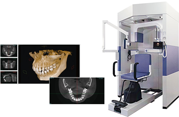 歯科用CT