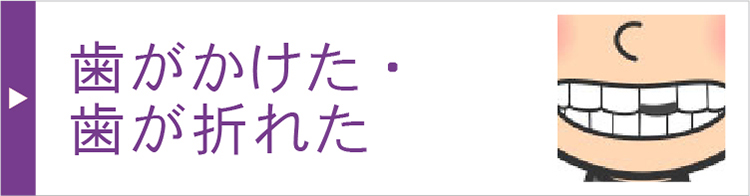 歯がかけた・歯が折れた